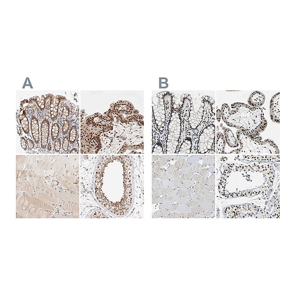 Atlas Antibodies Anti-GATAD2A Antibody