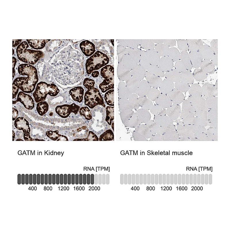 Atlas Antibodies Anti-GATM Antibody