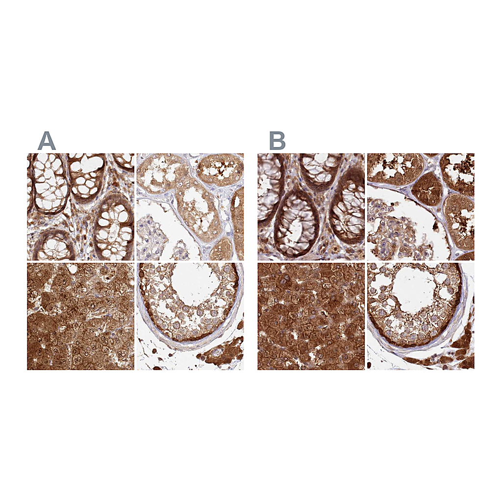 Atlas Antibodies Anti-GBE1 Antibody