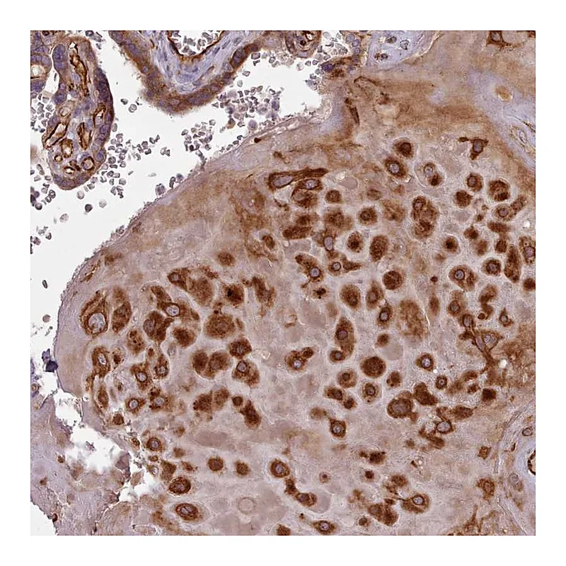 Atlas Antibodies Anti-GBGT1 Antibody