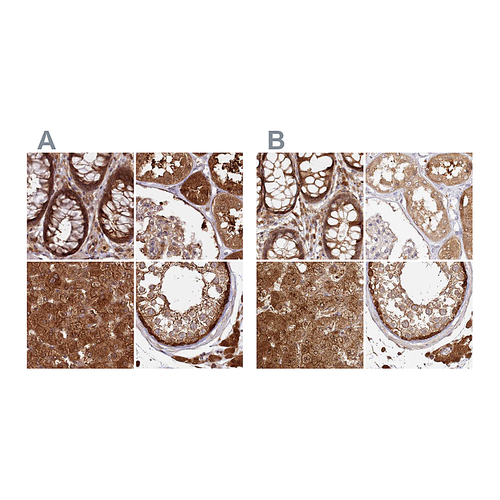 Atlas Antibodies Anti-GBE1 Antibody