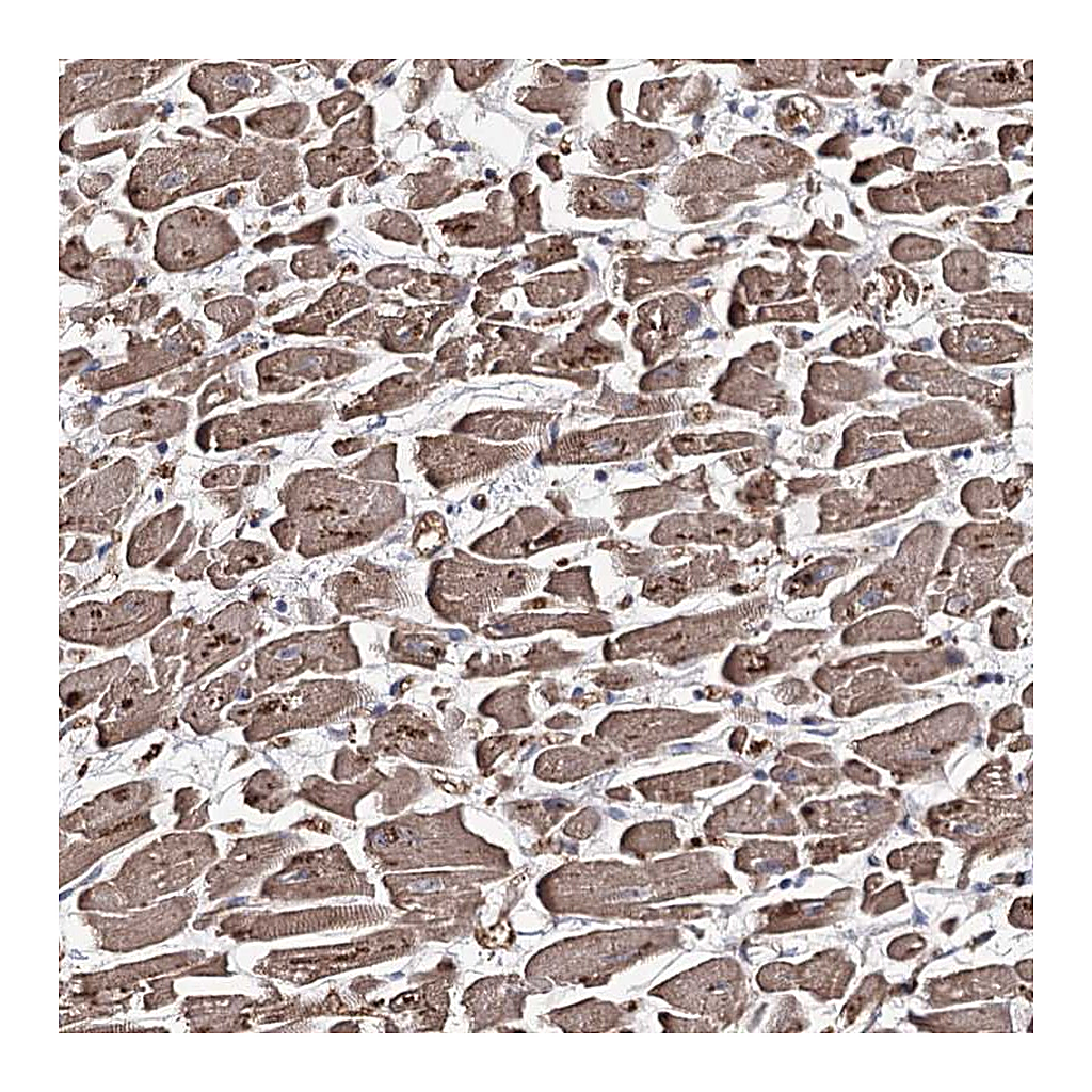 Atlas Antibodies Anti-GBF1 Antibody