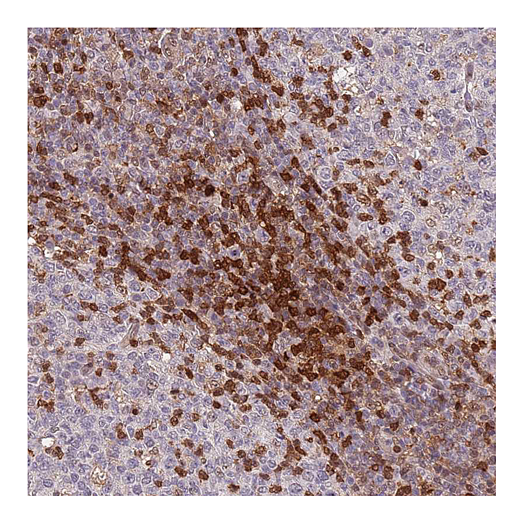 Atlas Antibodies Anti-GBP2 Antibody