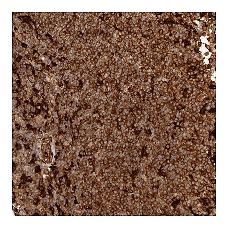 Atlas Antibodies Anti-GBP5 Antibody