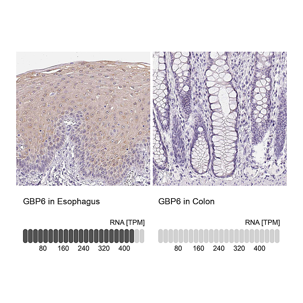 Atlas Antibodies Anti-GBP6 Antibody