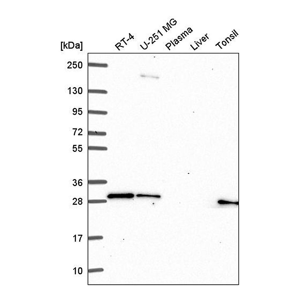 Atlas Antibodies Anti-GBX2 Antibody