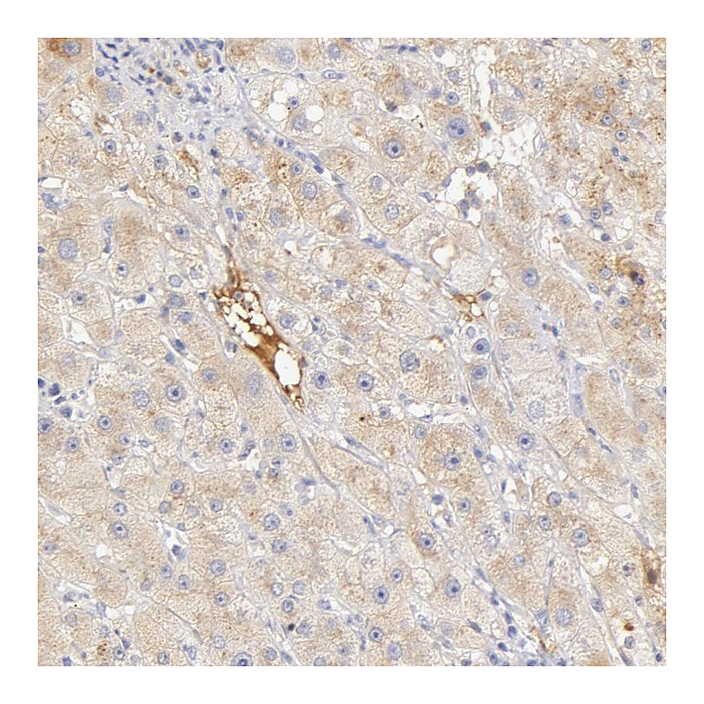 Atlas Antibodies Anti-GC Antibody