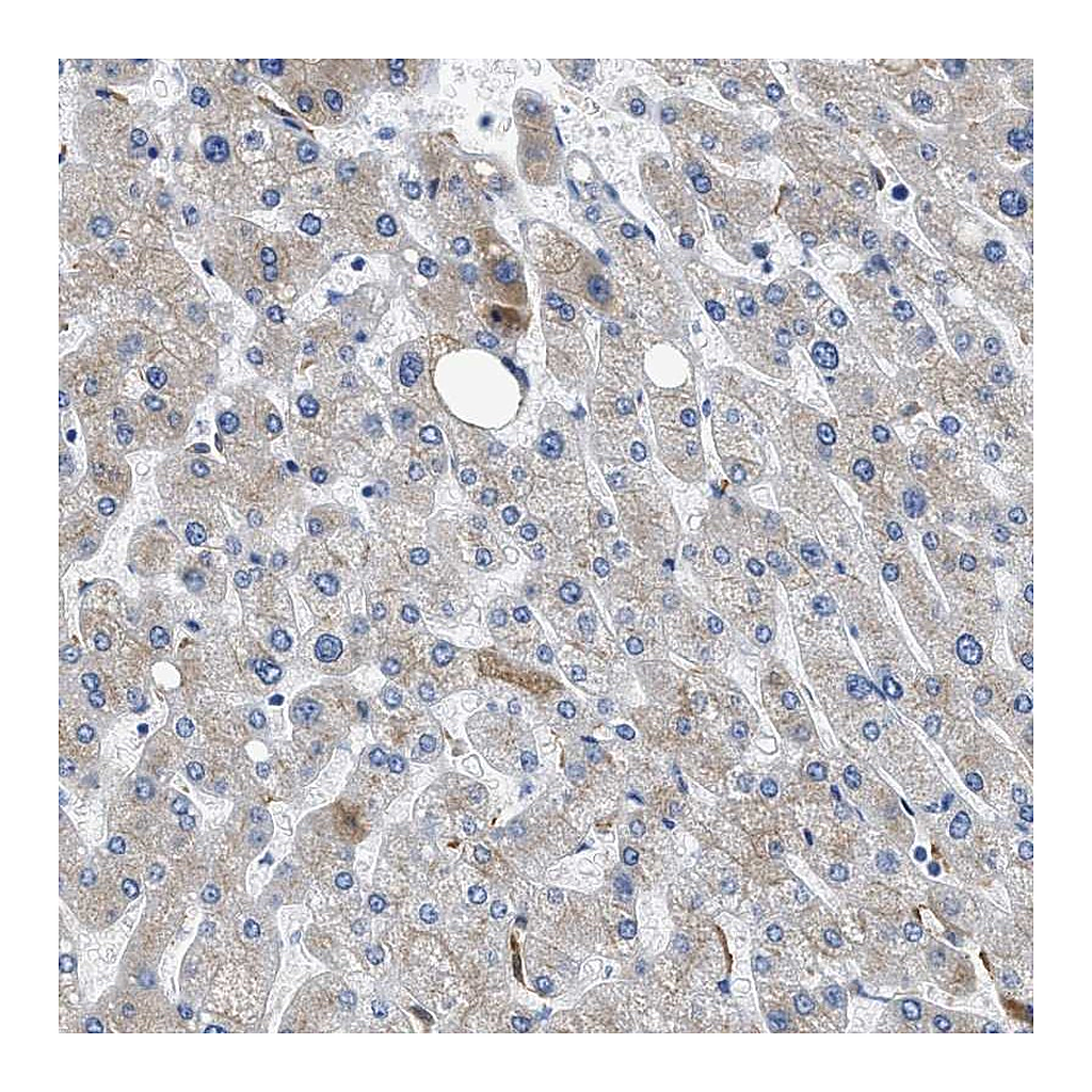 Atlas Antibodies Anti-GC Antibody