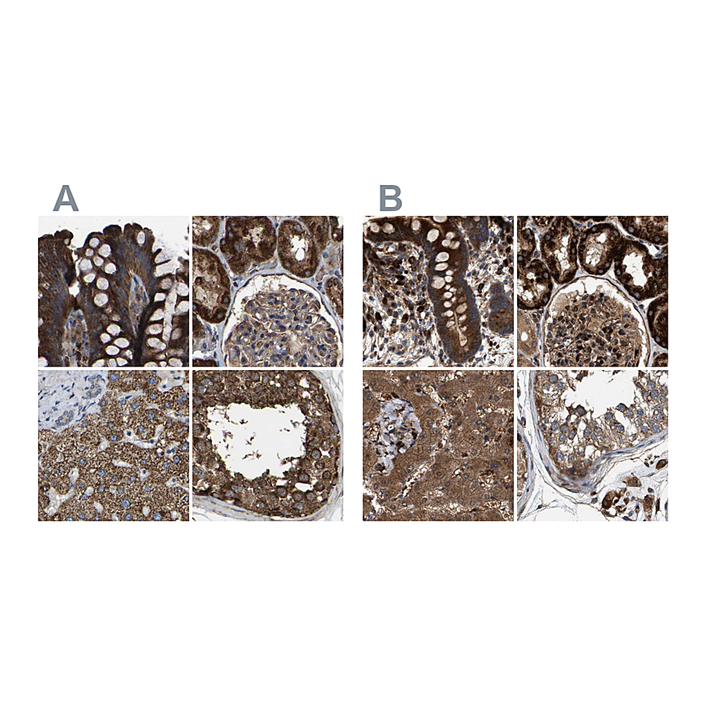 Atlas Antibodies Anti-GCC1 Antibody