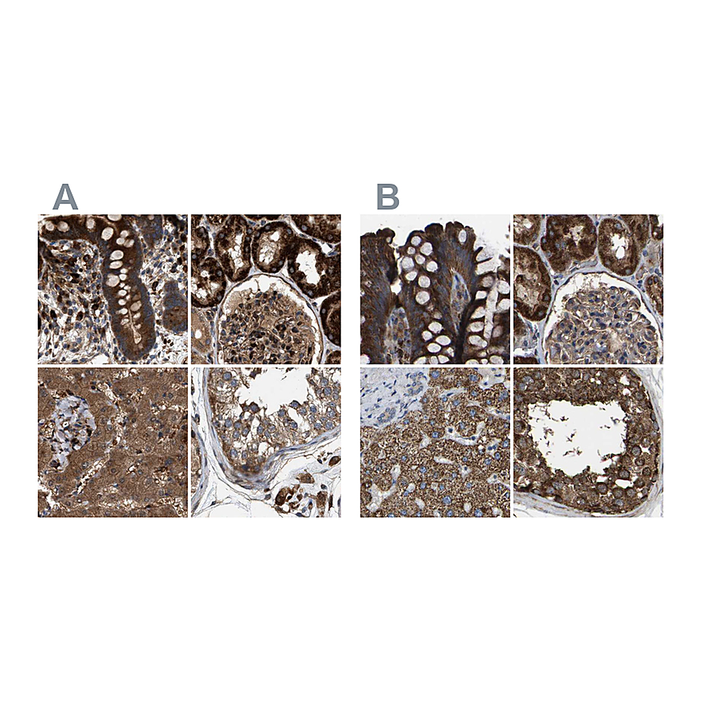 Atlas Antibodies Anti-GCC1 Antibody