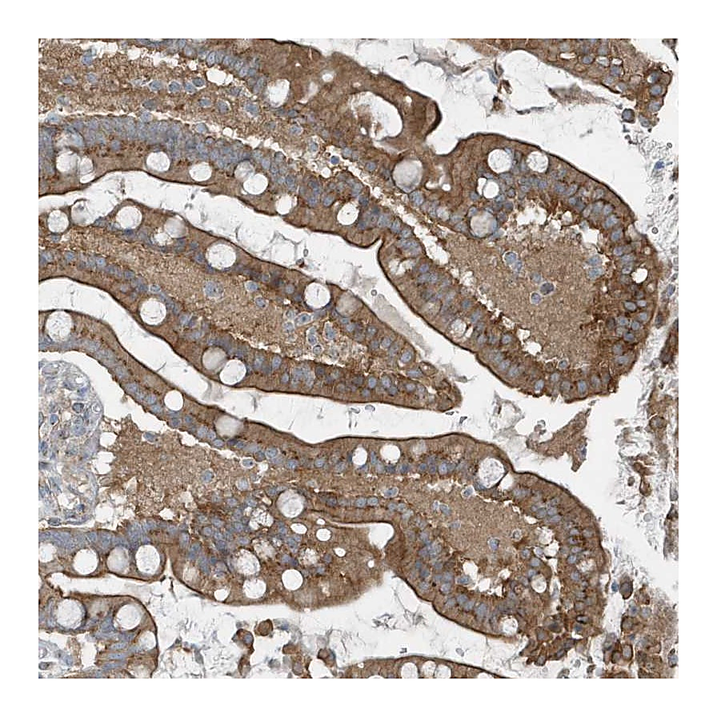 Atlas Antibodies Anti-GCC2 Antibody