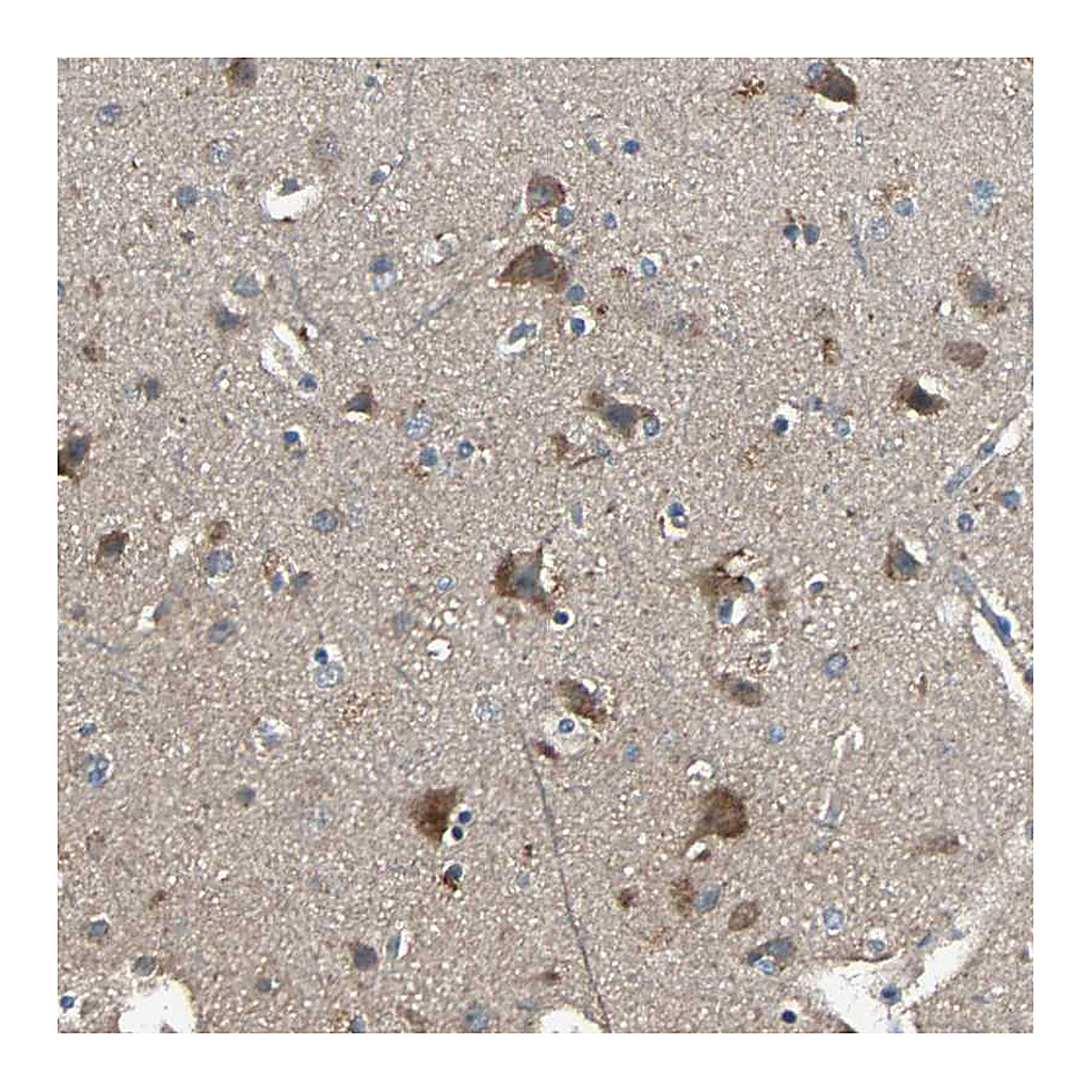 Atlas Antibodies Anti-GCK Antibody