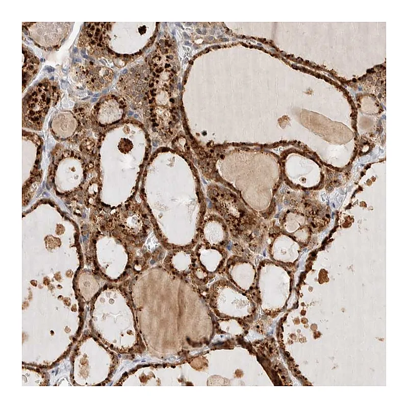 Atlas Antibodies Anti-GCLM Antibody