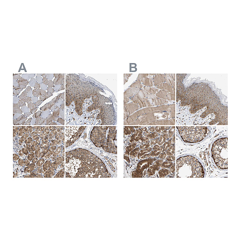 Atlas Antibodies Anti-GCN1 Antibody