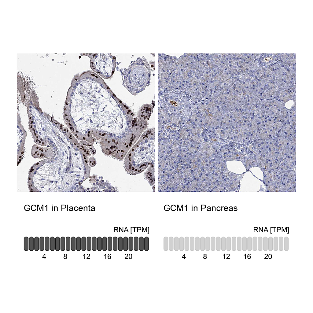 Atlas Antibodies Anti-GCM1 Antibody