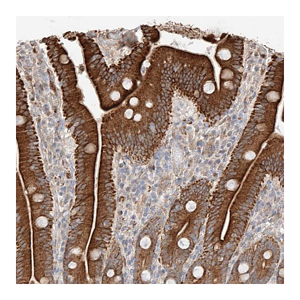 Atlas Antibodies Anti-GCNT1 Antibody