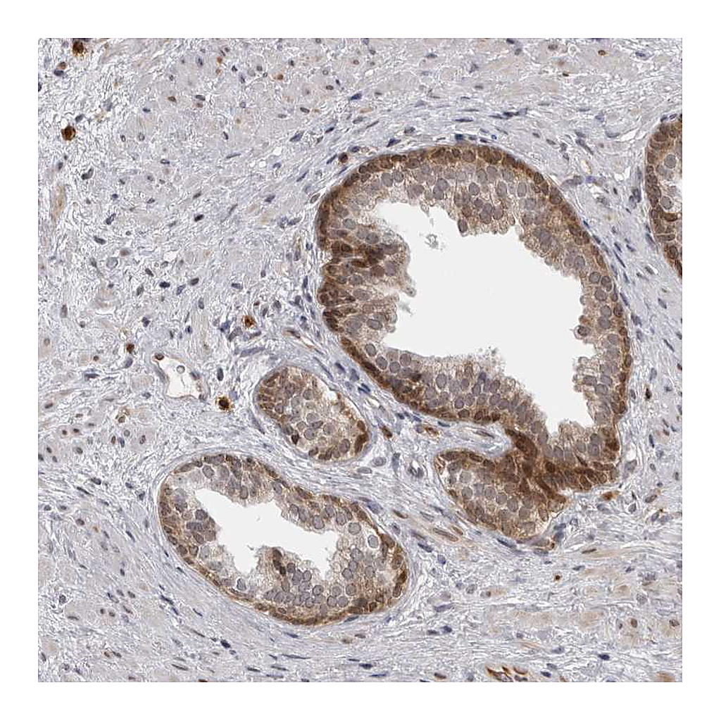 Atlas Antibodies Anti-GCSAML Antibody