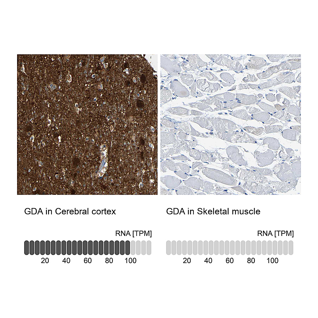 Atlas Antibodies Anti-GDA Antibody