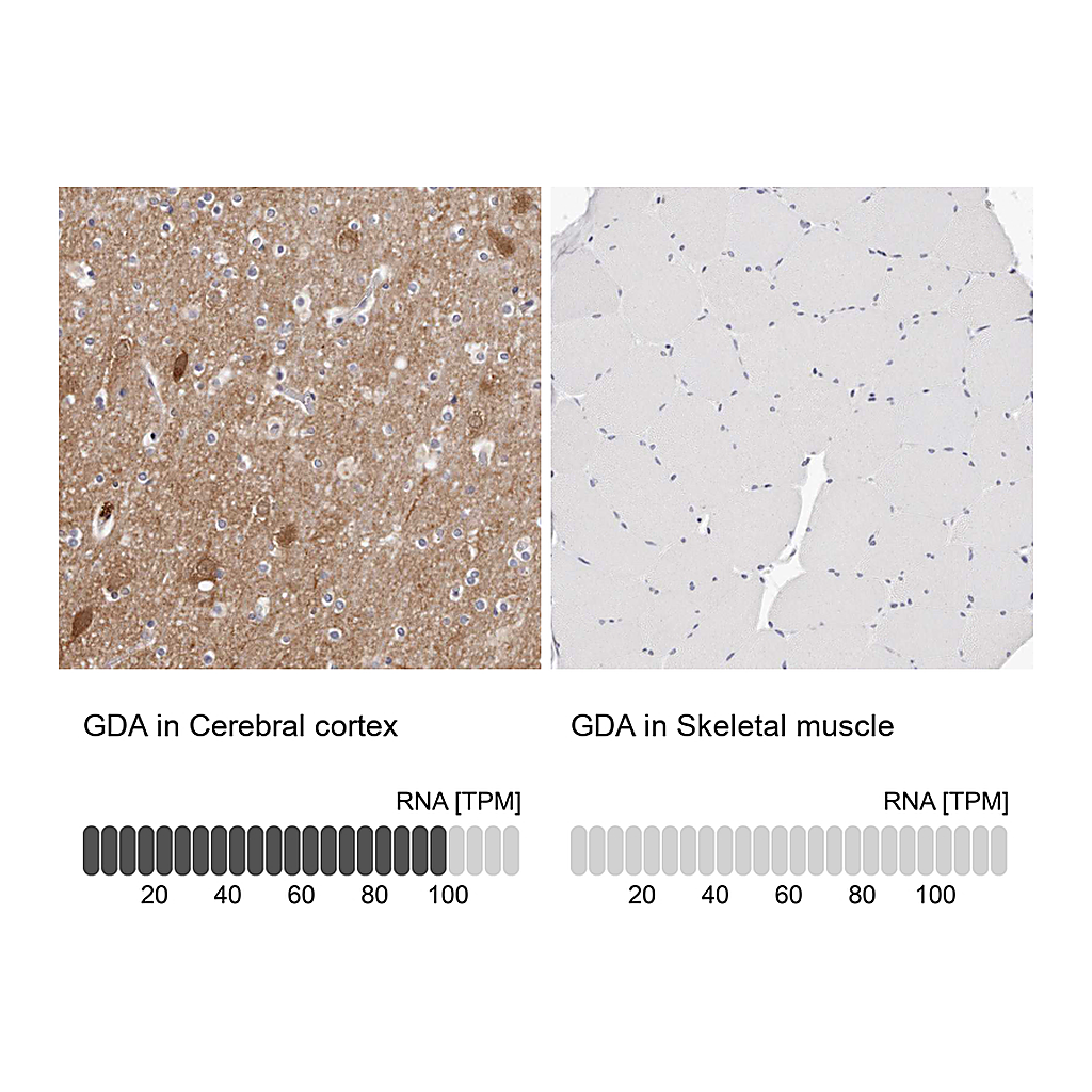 Atlas Antibodies Anti-GDA Antibody