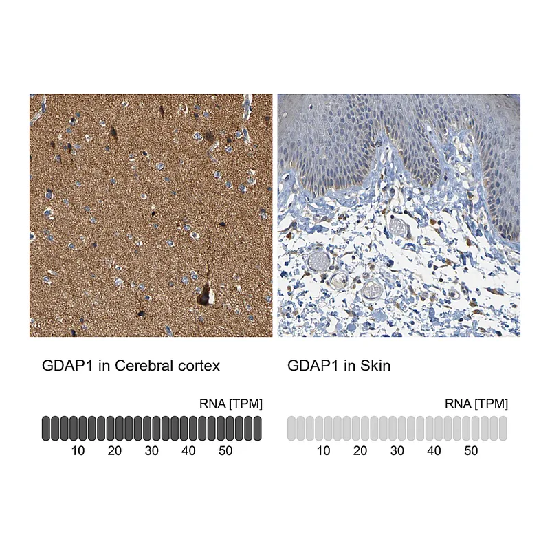 Atlas Antibodies Anti-GDAP1 Antibody