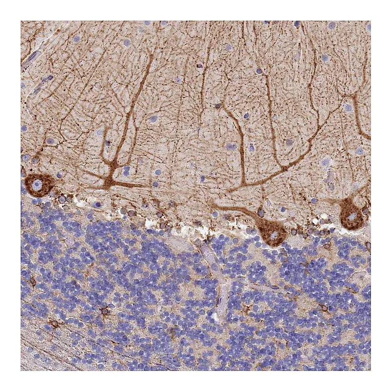Atlas Antibodies Anti-GDAP2 Antibody