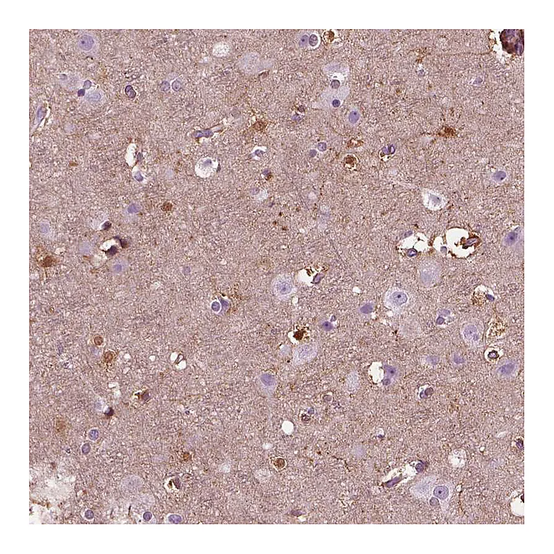 Atlas Antibodies Anti-GDF11 Antibody