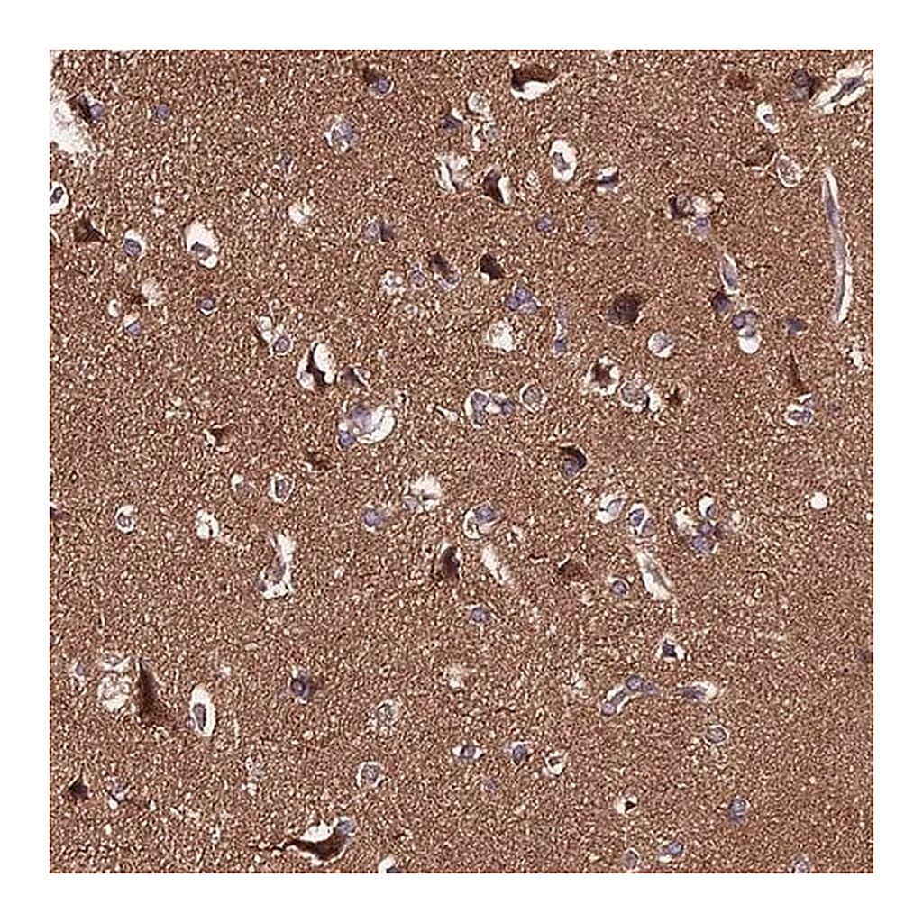 Merck Anti-PPP2R2B antibody produced in rabbit