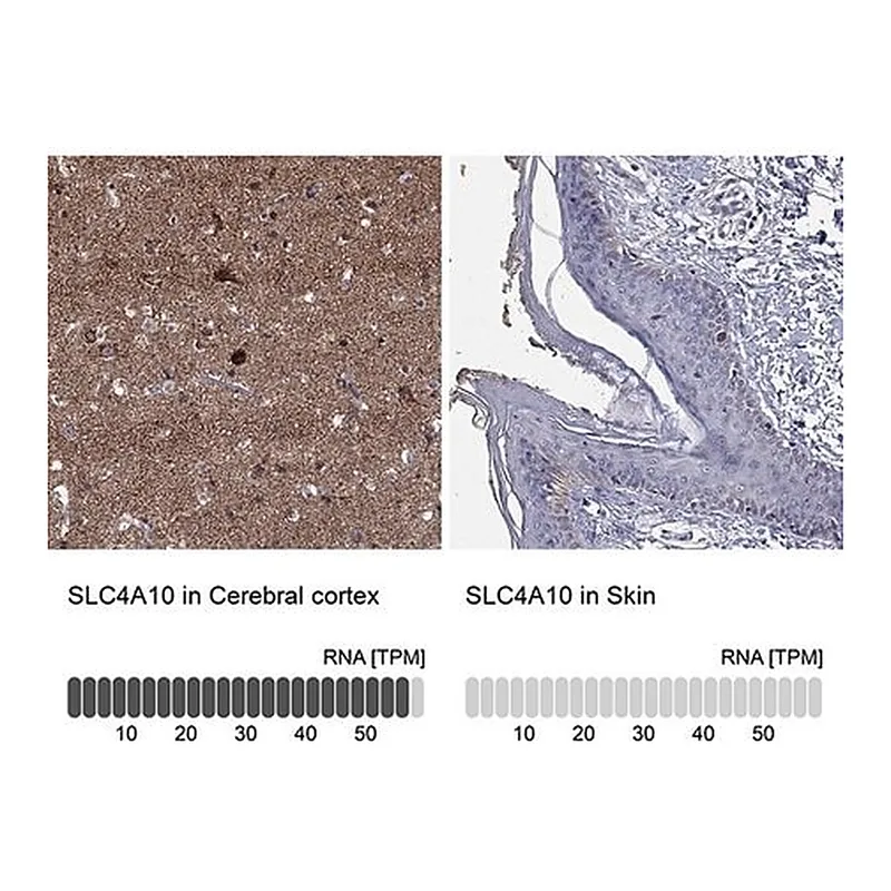 Merck Anti-SLC4A10 antibody produced in rabbit