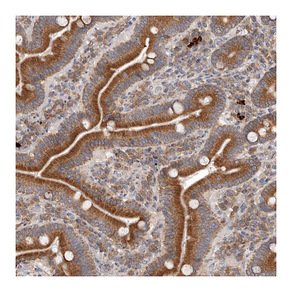 Atlas Antibodies Anti-TMUB1 Antibody
