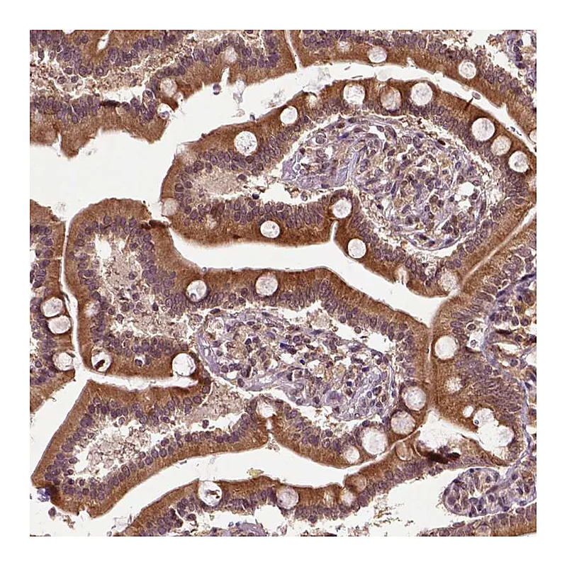 Atlas Antibodies Anti-TMX2 Antibody