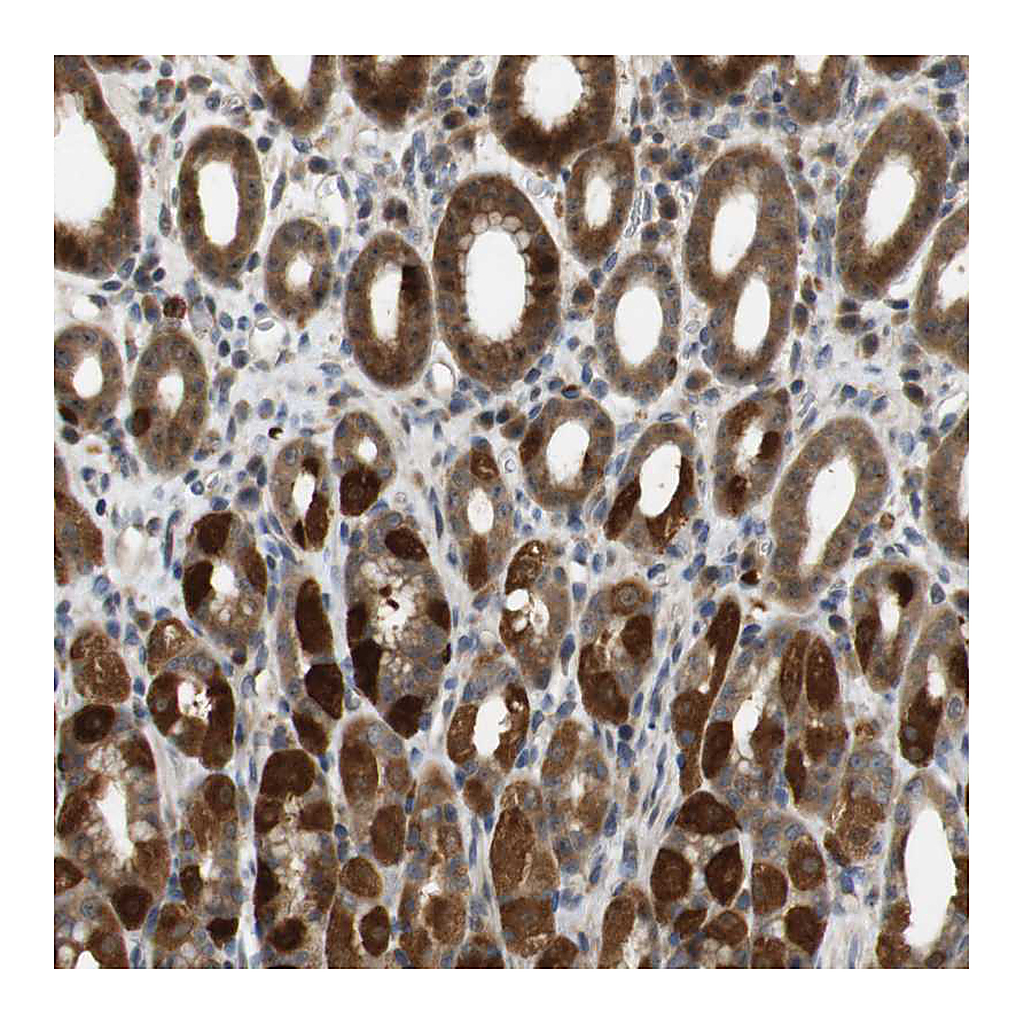 Atlas Antibodies Anti-TMX3 Antibody