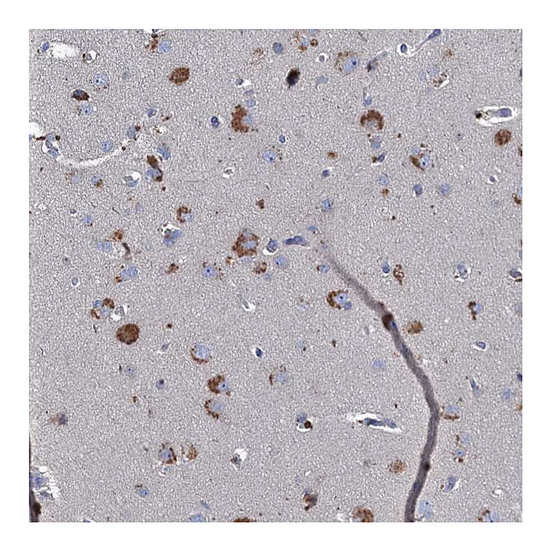Atlas Antibodies Anti-TMX2 Antibody