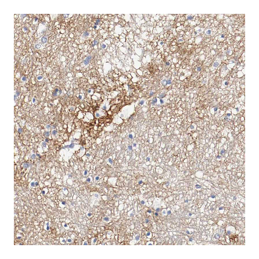 Atlas Antibodies Anti-TNC Antibody