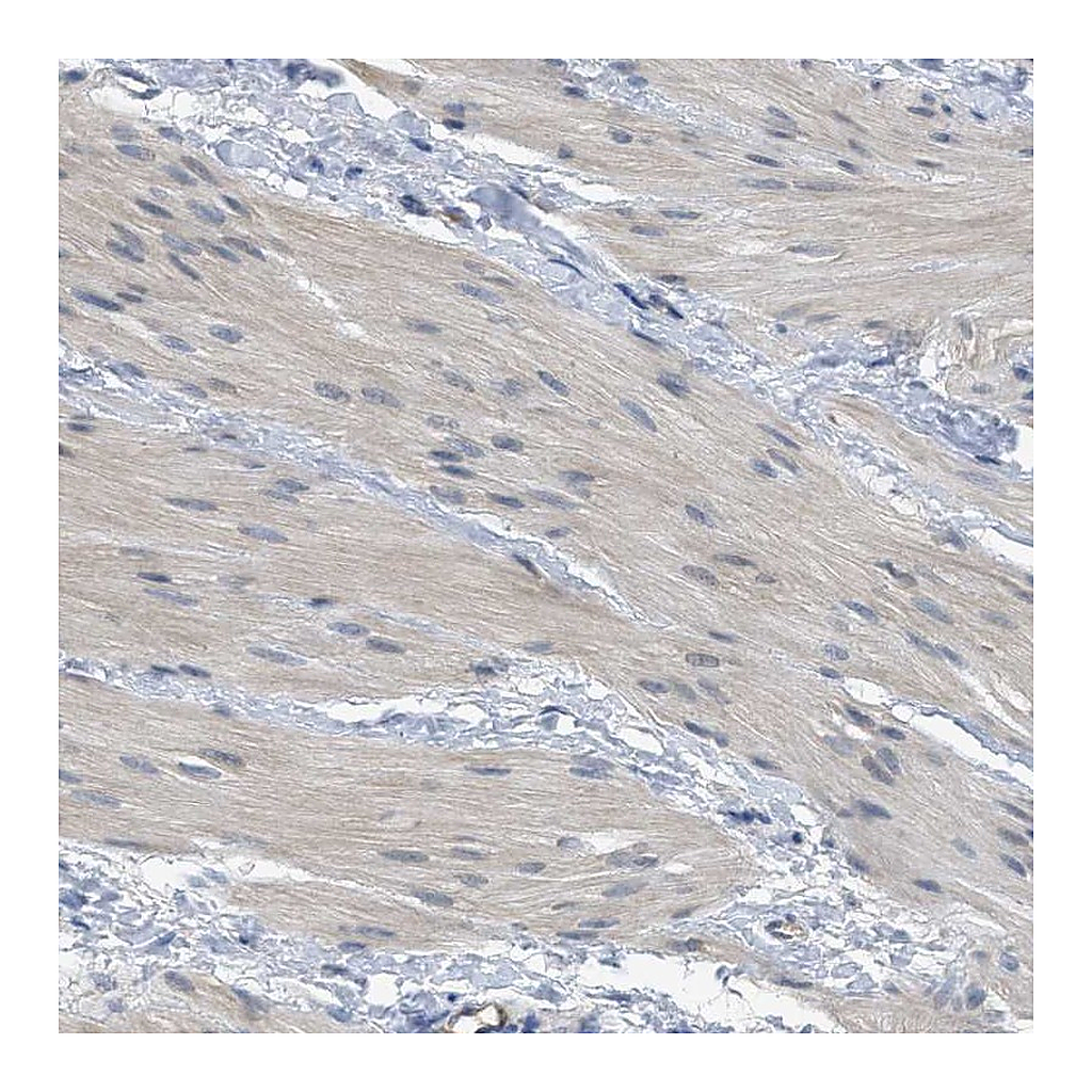 Atlas Antibodies Anti-TNFAIP1 Antibody