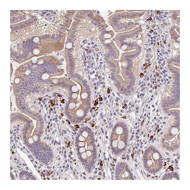 Atlas Antibodies Anti-TNFRSF10A Antibody