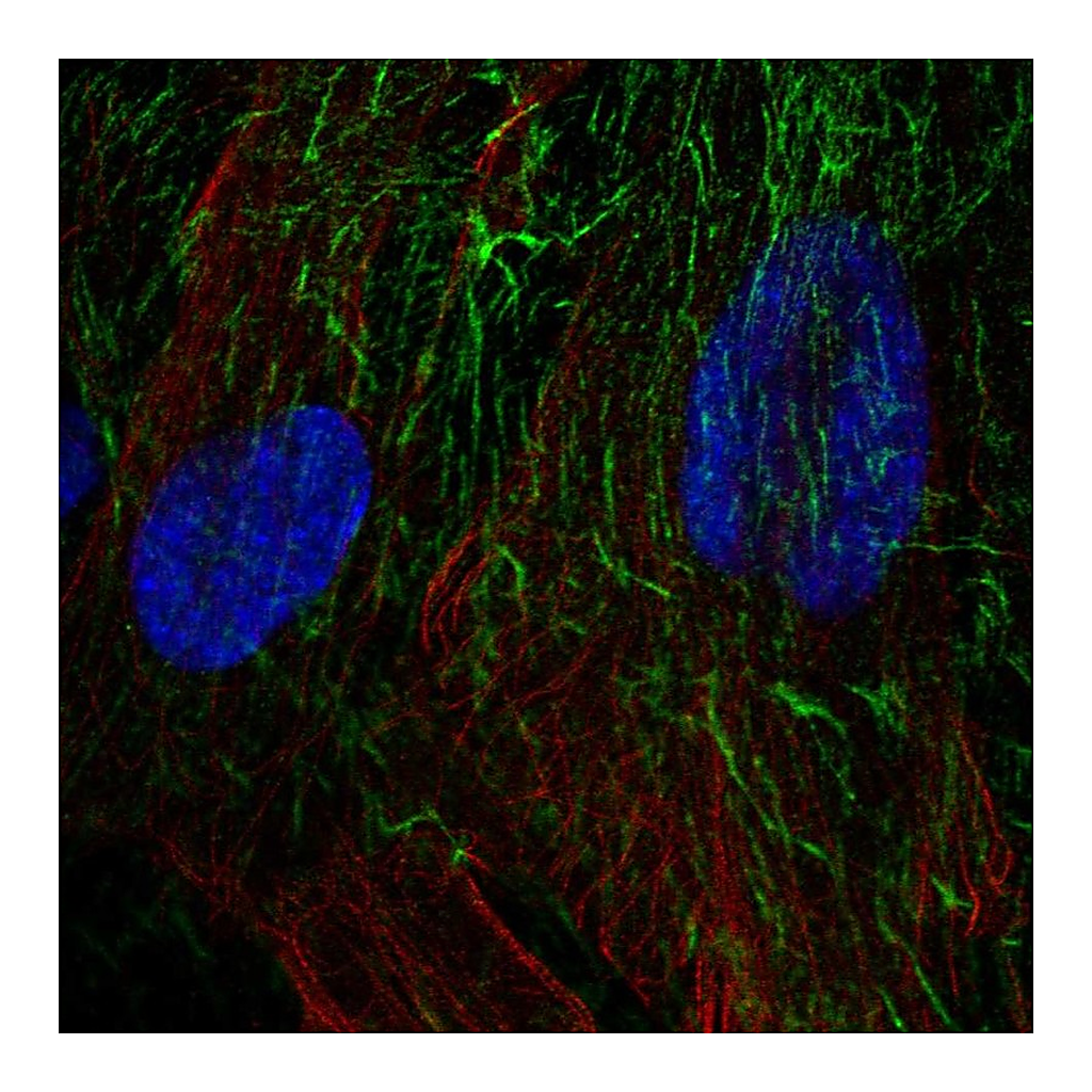 Atlas Antibodies Anti-TNFRSF10D Antibody