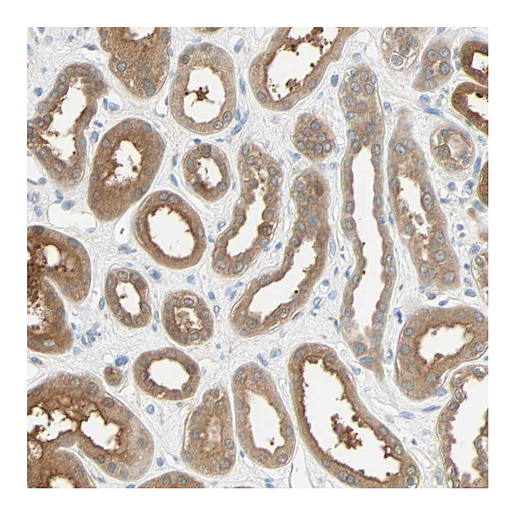 Atlas Antibodies Anti-TNFRSF12A Antibody