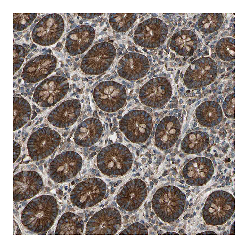 Atlas Antibodies Anti-TNFRSF1A Antibody