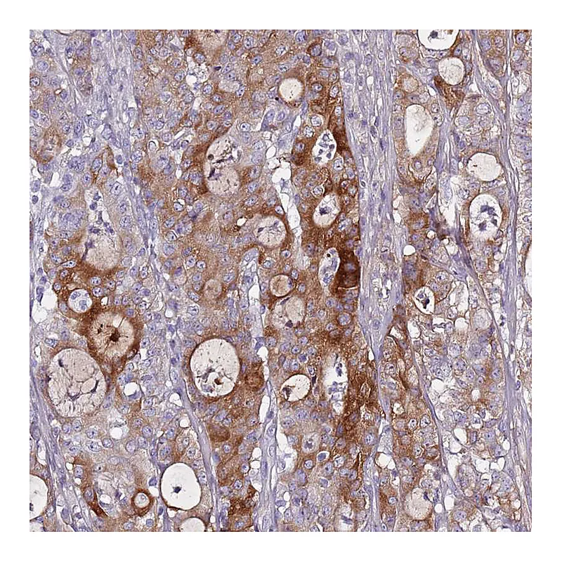 Atlas Antibodies Anti-TNFRSF6B Antibody
