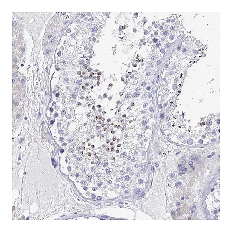 Atlas Antibodies Anti-TNFRSF8 Antibody
