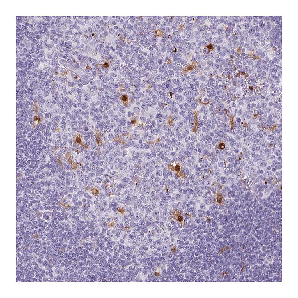Atlas Antibodies Anti-TNFRSF8 Antibody