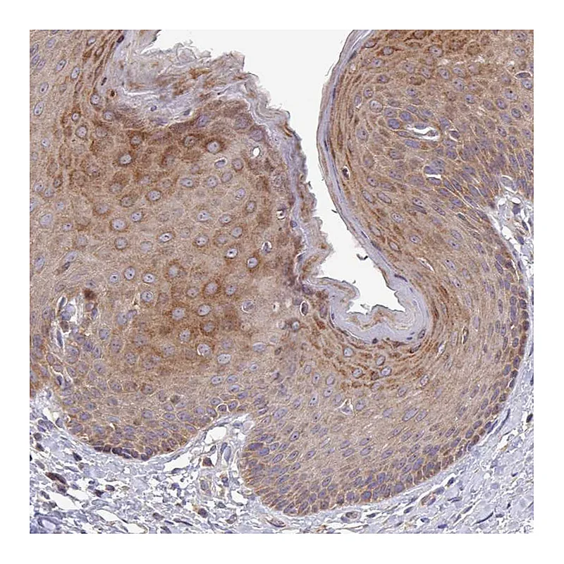 Atlas Antibodies Anti-TNFSF12 Antibody