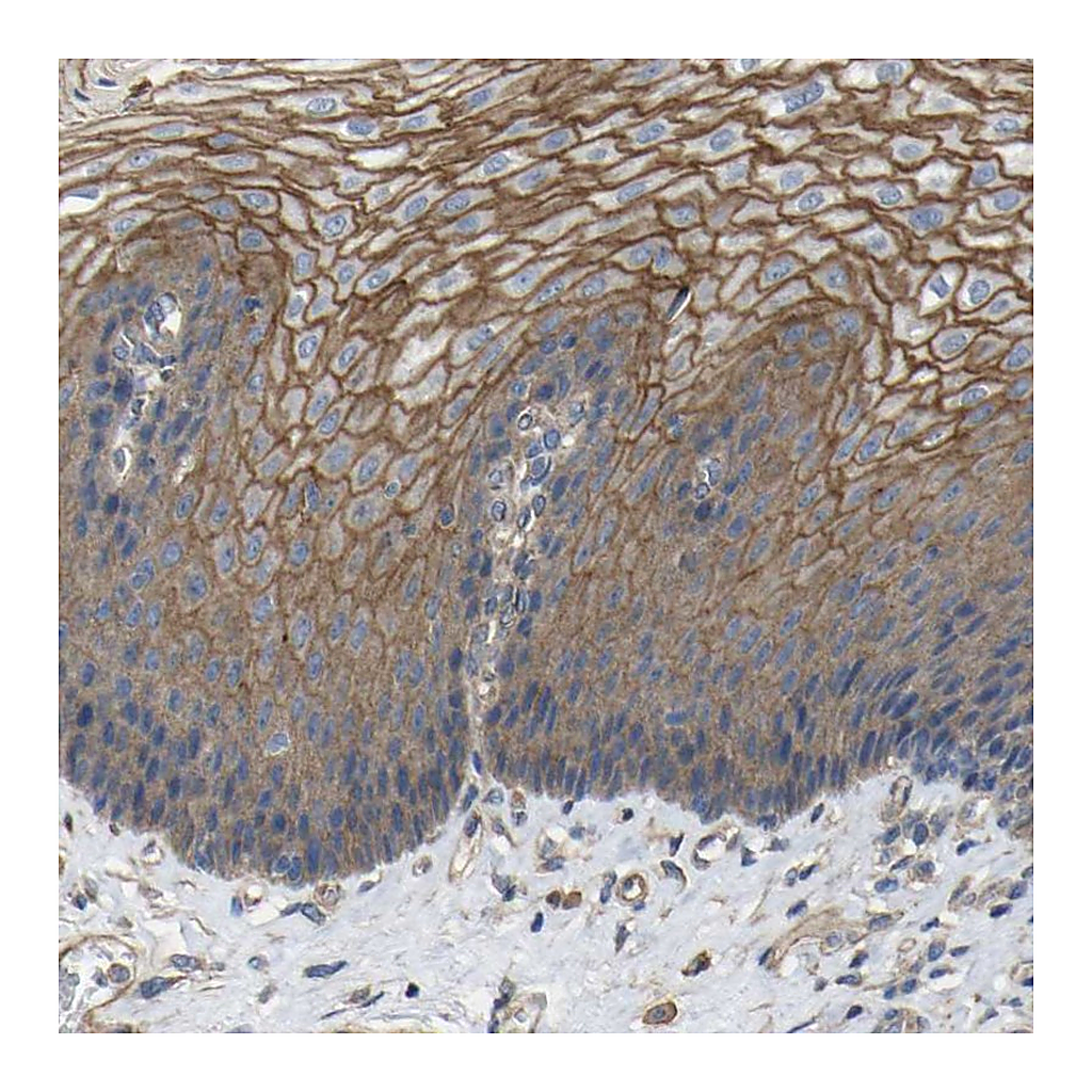 Atlas Antibodies Anti-TNFSF15 Antibody