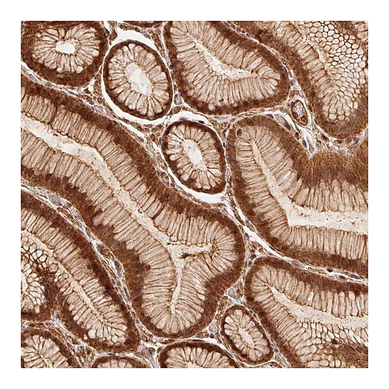 Atlas Antibodies Anti-TNIP2 Antibody