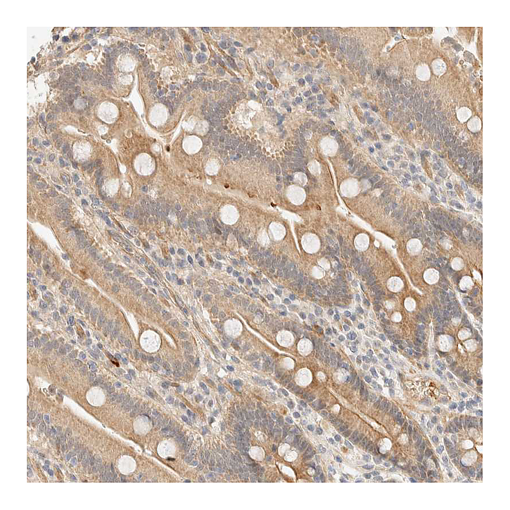Atlas Antibodies Anti-TNK1 Antibody