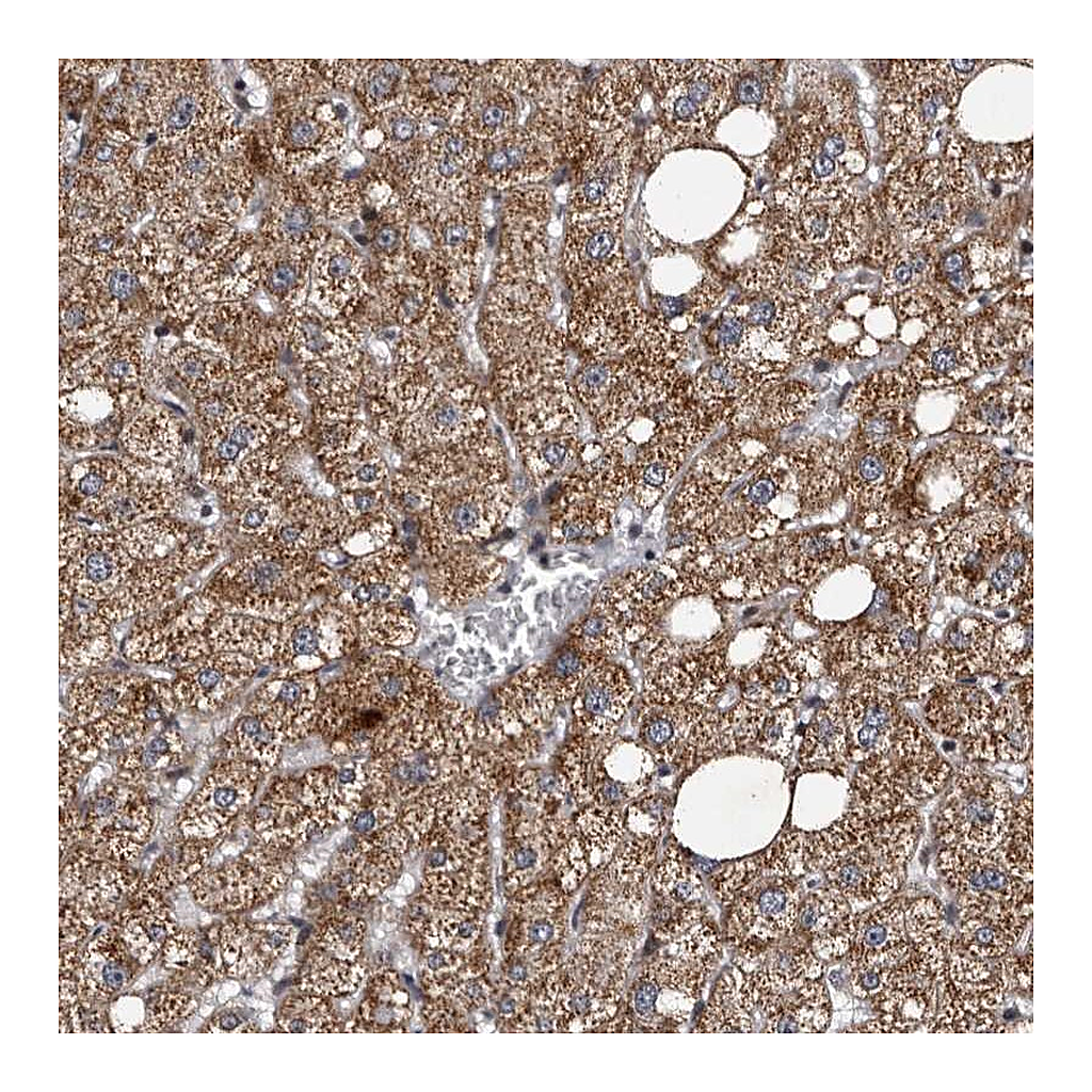 Atlas Antibodies Anti-TNKS Antibody