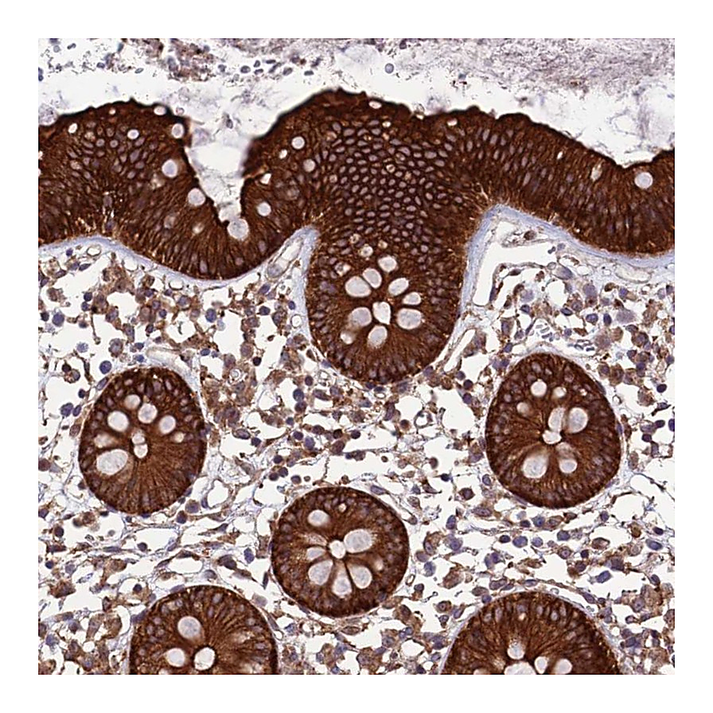 Atlas Antibodies Anti-TNIP3 Antibody
