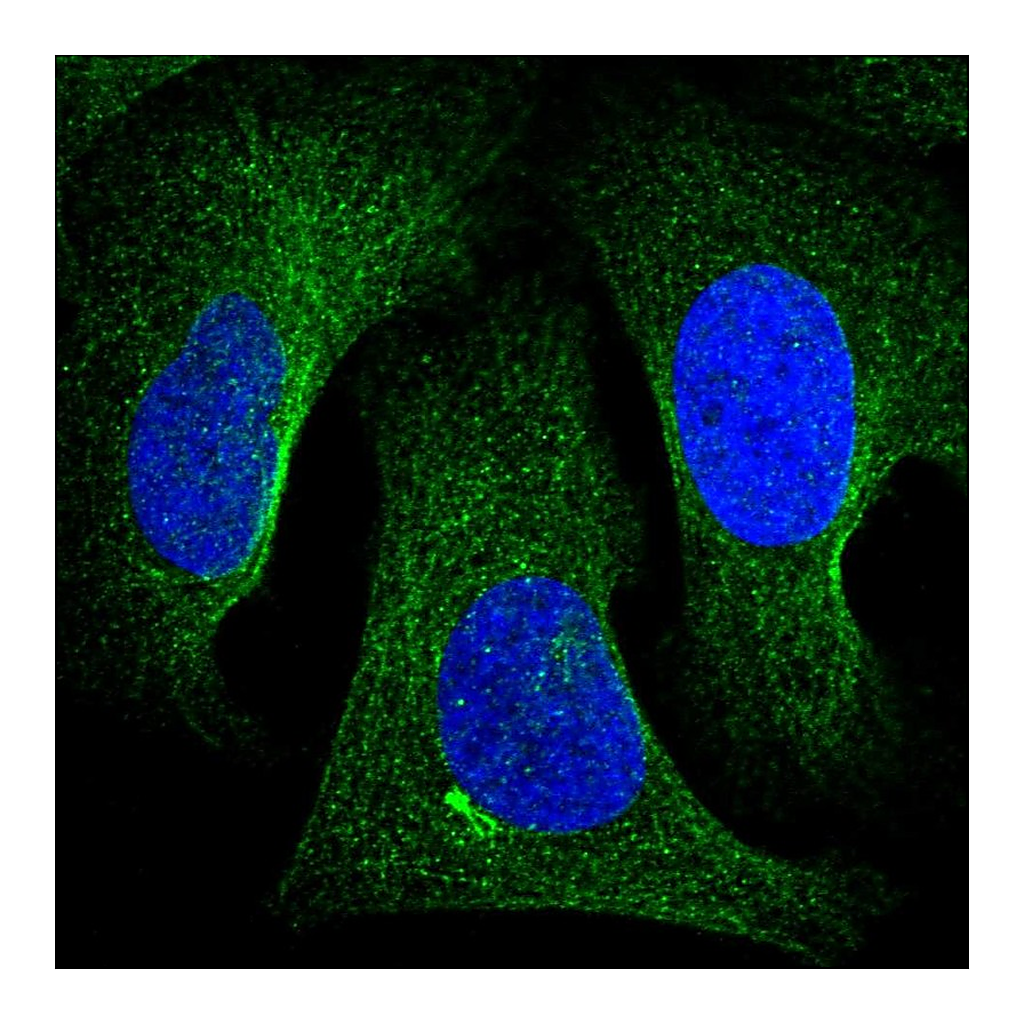 Atlas Antibodies Anti-TNKS2 Antibody