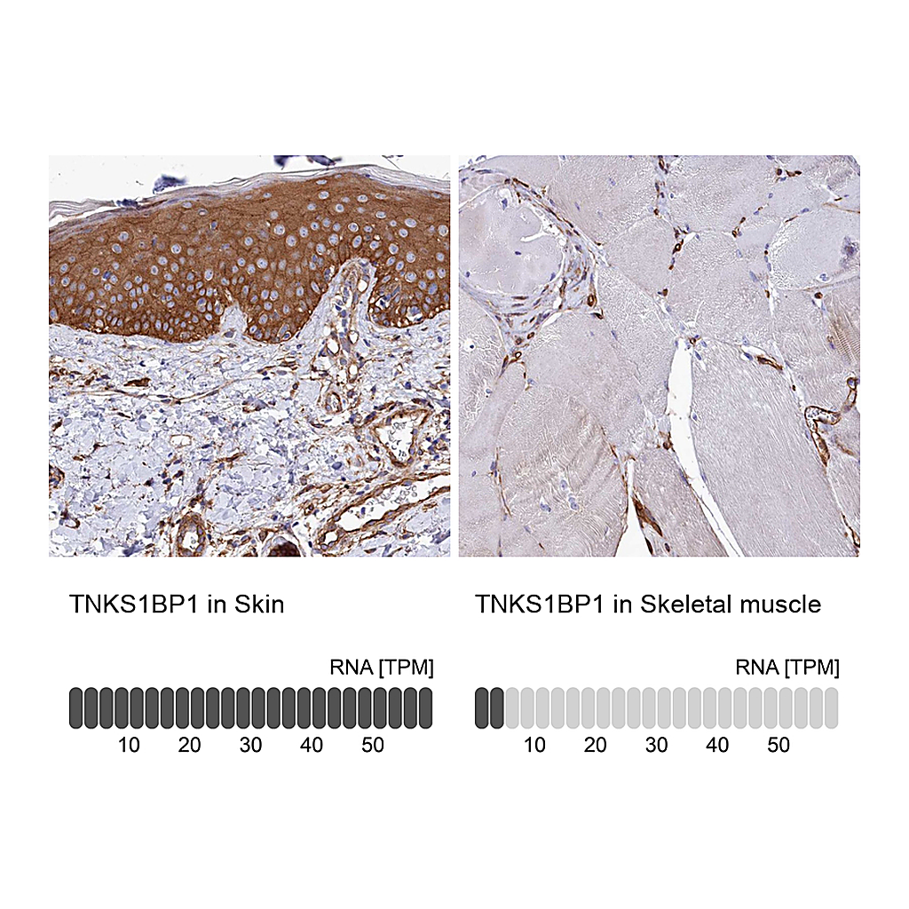 Atlas Antibodies Anti-TNKS1BP1 Antibody