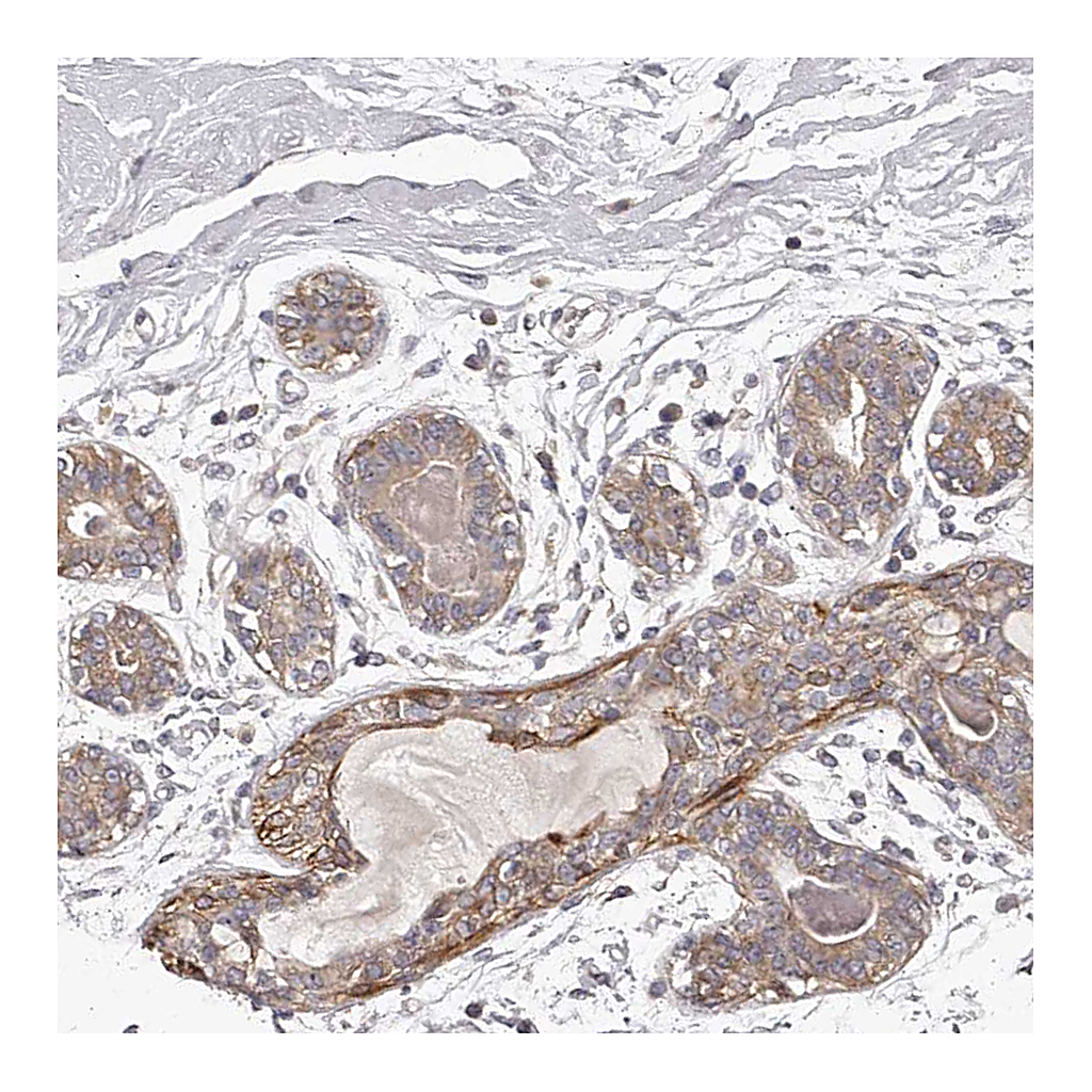 Atlas Antibodies Anti-TNN Antibody